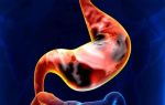 Патологии слизистой оболочки желудка и методы их лечения