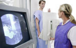 Рентген желудка с барием что показывает, последствия