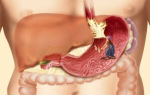 Как проверить желудок без гастроскопии — способы обследования