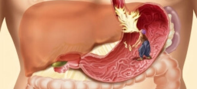 Как проверить желудок без гастроскопии — способы обследования