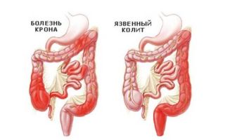 Узи желудка и кишечника: показания к проведению и что показывает исследование