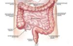 Заболевания кишечника: симптомы, признаки и лечение, классификация, названия