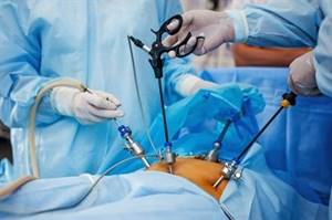 Лапароскопия желчного пузыря - операция по удалению, отзывы, сколько стоит и длится