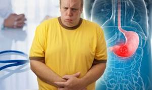Несварение желудка: причины, симптомы лечение диспепсии