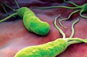 helicobacter pylori: симптомы (на лице, со стороны ЖКТ), диагностика и лечение