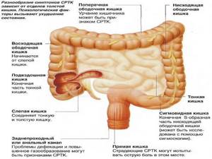 Расстройство кишечника — симптомы и лечение