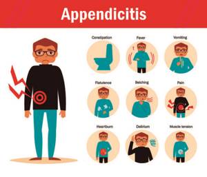 Симптомы аппендицита у взрослых - причины, диагностика и признаки приступа