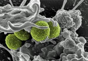 Восстановление микрофлоры кишечника: препараты и продукты после антибиотиков