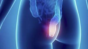Боль в заднем проходе у женщин: причины боли в анальном отверстии, тянущая, резкая, тупая