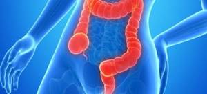 Дивертикулез толстого кишечника: симптомы и лечение, дивертикулярная болезнь