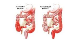 УЗИ желудка и кишечника: показания к проведению и что показывает исследование
