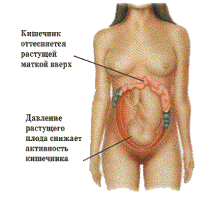 Понос как признак беременности до задержки - расстройство желудка