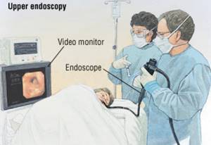 Эндоскопия желудка что это такое? Подготовка, эндоскопическое исследование желудка