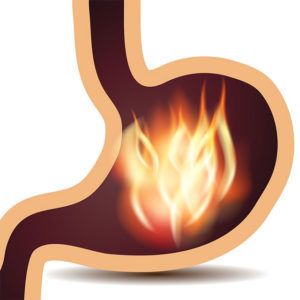 Постоянное жжение в желудке: основные причины и лечение