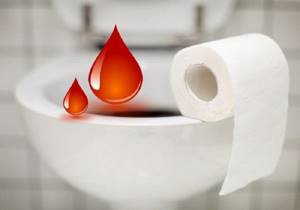 Причины наличия крови в кале и его последствия - сходила в туалет по большому с кровью