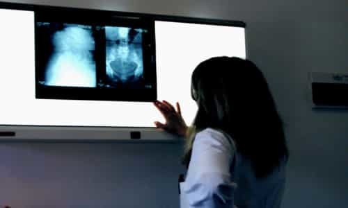 Рентгеноскопия желудка и пищевода с барием, подготовка