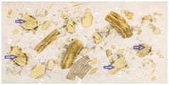 Растительная неперевариваемая клетчатка в кале у взрослого. Непереваренные мышечные волокна в Кале под микроскопом. Копрология кала микроскопия. Микроскопия кала растительная клетчатка непереваримая. Мышечные волокна в Кале микроскопия.