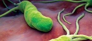 Инфекция Хеликобактер пилори: от чего появляется микроб в желудке, симптомы