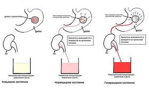 Способы определения уровня кислотности желудка - ph желудочного сока