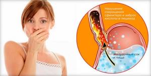 Изжога в горле: причины, симптомы и лечение