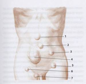 Признаки грыжи на животе у мужчин и женщин - симптомы брюшной грыжи