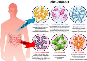 Как восстановить микрофлору кишечника после приема антибиотиков