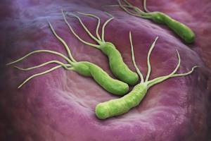 Инфекция Хеликобактер пилори: от чего появляется микроб в желудке, симптомы