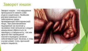 Заворот желудка: причины, симптомы, лечение