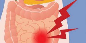 Боли и спазмы в кишечнике, диарея: причины, диагностика и лечение