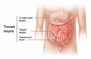 Заболевания кишечника: симптомы, признаки и лечение, классификация, названия