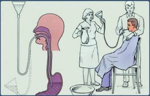 Отравление арбузом: признаки, симптомы и лечение в домашних условиях